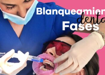 blanqueamiento dental